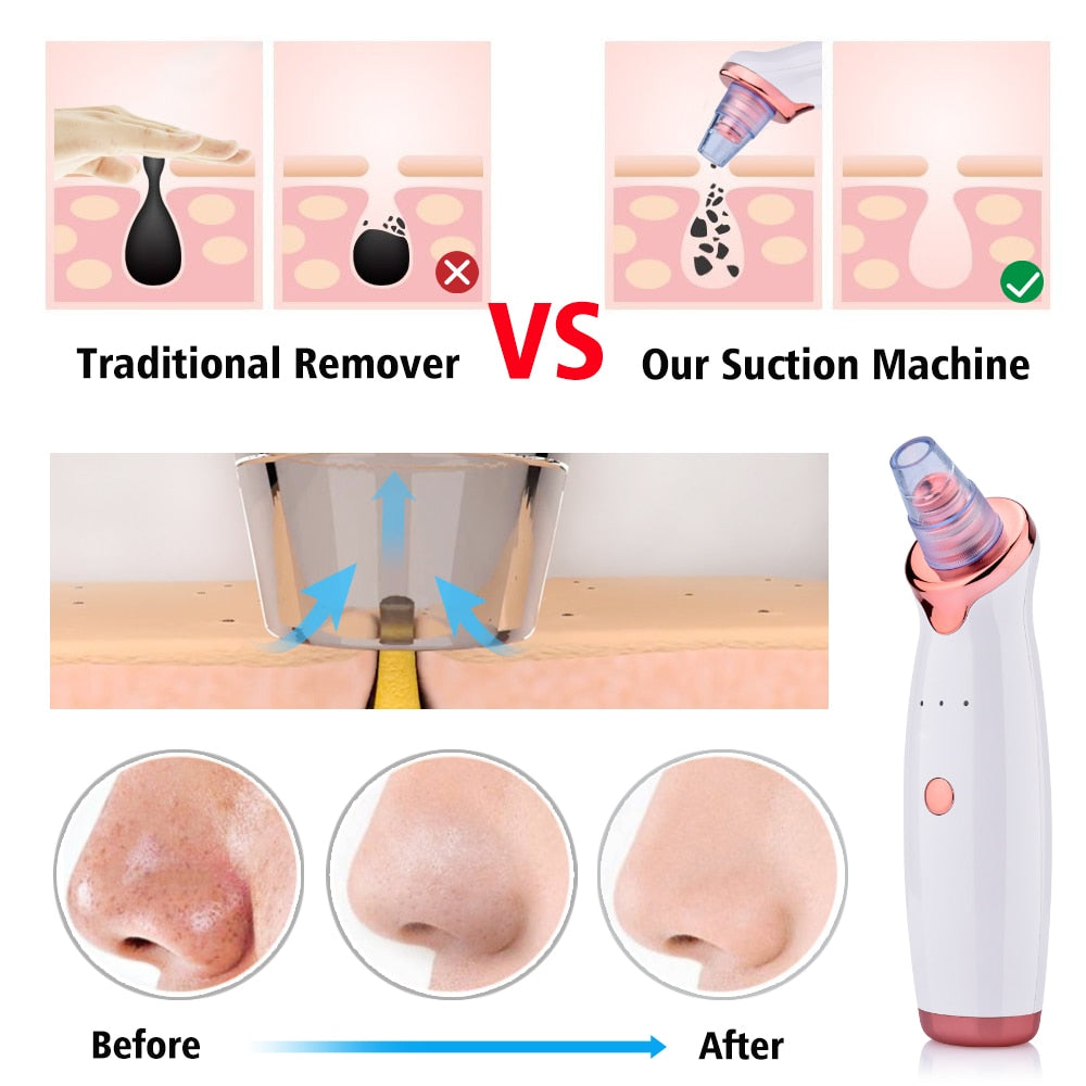 Electric Facial Cleansing Device for Pore Care, Rechargeable Beauty Tool